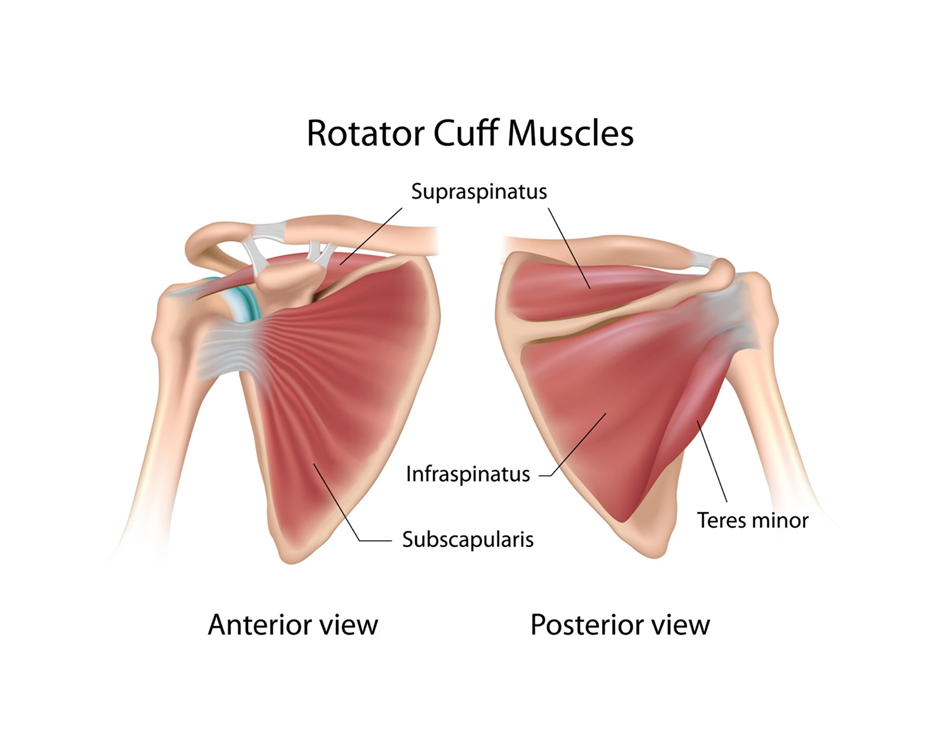Rotator Cuff Tear